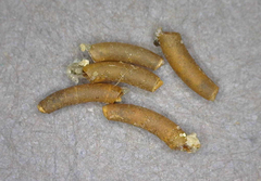 Caecum dextroversum