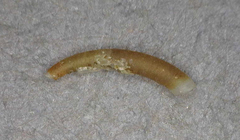 Caecum dextroversum