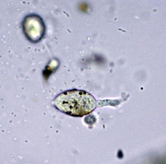 Chytridiomycota