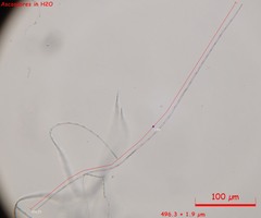 Acrospermum compressum