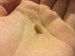 Colpospira guillaumei