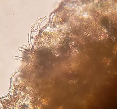 Pucciniastrum pyrolae