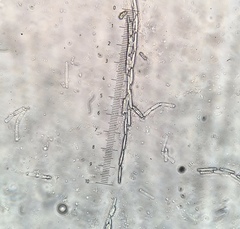 Tolypocladium capitatum