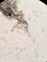 Coprinellus flocculosus