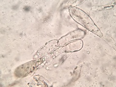 Coprinellus flocculosus