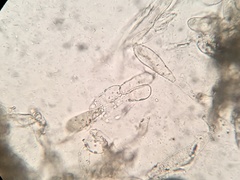 Coprinellus flocculosus