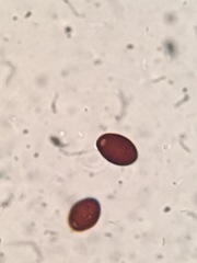 Coprinellus flocculosus