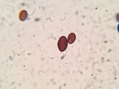 Coprinellus flocculosus