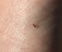 Wasmannia auropunctata