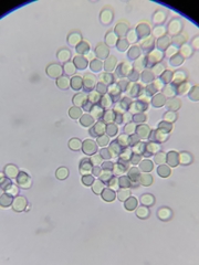 Aspergillus
