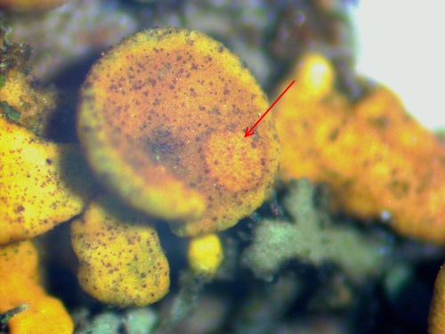 Tremella caloplacae
