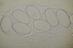 Ascobolus immersus