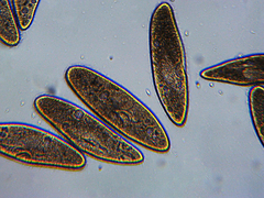 Paramecium multimicronucleatum