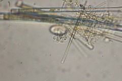 Dictyosphaerium
