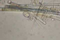 Dictyosphaerium