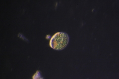 Paramecium bursaria