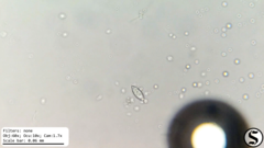 Chlorogonium