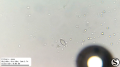 Chlorogonium