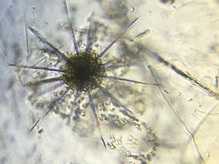 Acanthometron