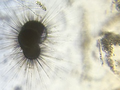Orbulina