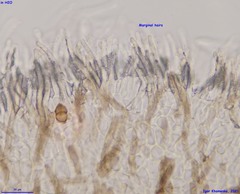 Fuscolachnum misellum