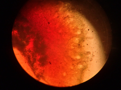 Mycoblastus sanguinarius