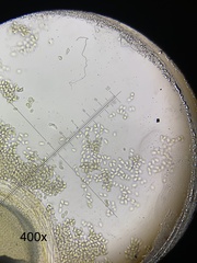 Pilobolus crystallinus