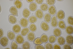 Pucciniastrum symphyti