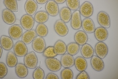 Pucciniastrum symphyti