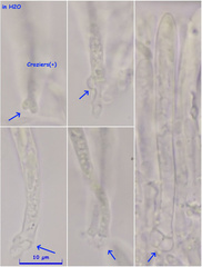 Pyrenopeziza petiolaris