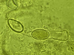 Chaetothiersia vernalis