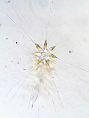 Asterionellopsis glacialis