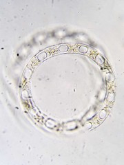 Eucampia zodiacus