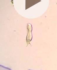 Gastrotricha