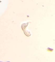 Gastrotricha