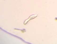 Gastrotricha