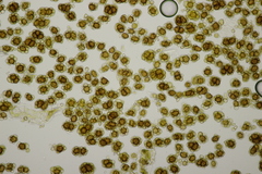 Urocystis colchici