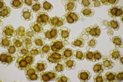 Urocystis colchici