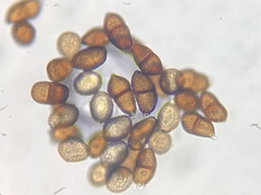 Puccinia vincae