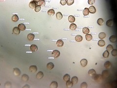 Reticularia intermedia