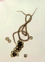 Trichia botrytis