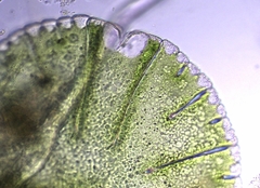 Micrasterias denticulata