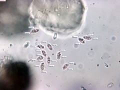 Peniophorella pubera