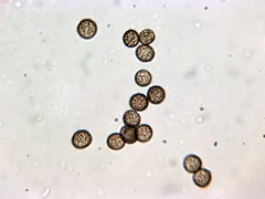 Reticularia jurana