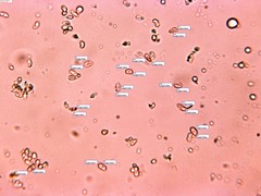 Phlebia nothofagi