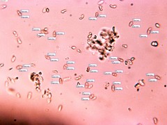 Phlebia nothofagi
