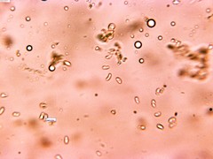Phlebia nothofagi