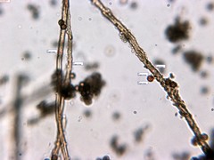 Schenella microspora