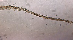 Schenella microspora