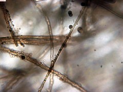 Schenella microspora